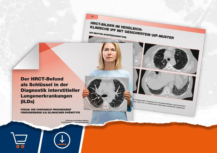 HRCT-Booklet