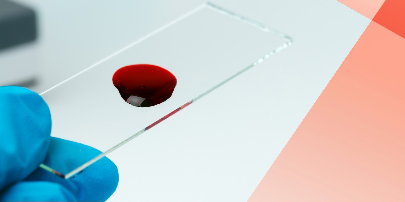 Labor-Glasobjektträger mit Blutstropfen